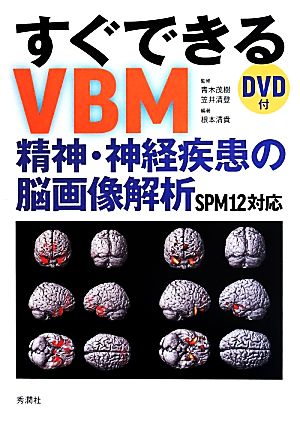 すぐできるVBM 精神・神経疾患の脳画像解析SPM12対応