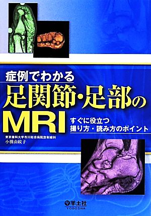 症例でわかる足関節・足部のMRI すぐに役立つ撮り方・読み方のポイント