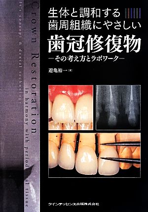 生体と調和する歯周組織にやさしい歯冠修復物 その考え方とラボワーク