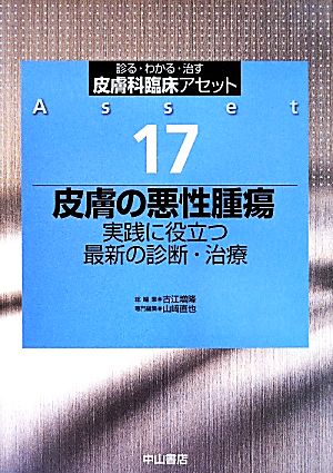 皮膚の悪性腫瘍 実践に役立つ最新の診断・治療 診る・わかる・治す 皮膚科臨床アセット17