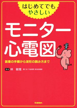 はじめてでもやさしいモニター心電図 装着の手順から波形の読み方まで