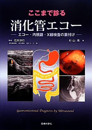 ここまで診る消化管エコー エコー・内視鏡・X線検査の裏付け