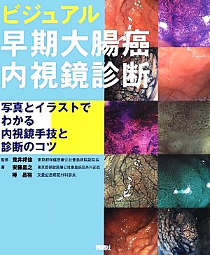 ビジュアル早期大腸癌内視鏡診断 写真とイラストでわかる内視鏡手技と診断のコツ