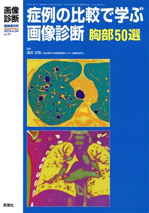 症例の比較で学ぶ画像診断 胸部50選