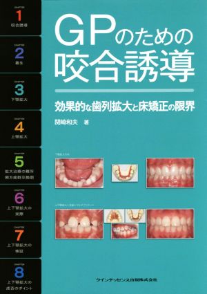 GPのための咬合誘導 効果的な歯列拡大と床矯正の限界