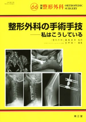 整形外科の手術手技 私はこうしている 別冊整形外科No.66