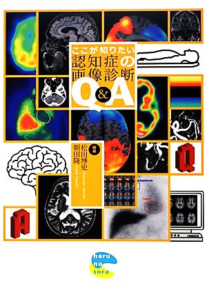 ここが知りたい認知症の画像診断Q&A