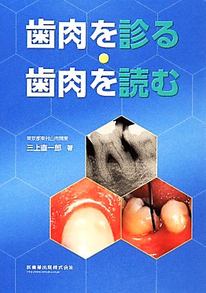 歯肉を診る・歯肉を読む