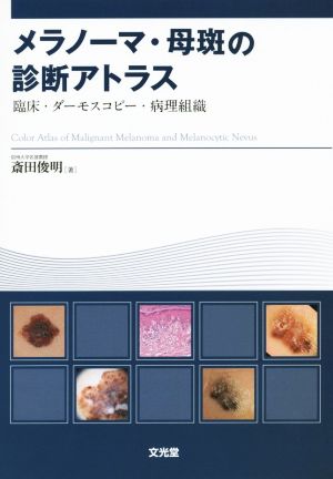 メラノーマ・母斑の診断アトラス 臨床・ダーモスコピー・病理組織