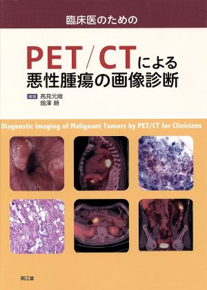 臨床医のためのPET/CTによる悪性腫瘍の画像診断