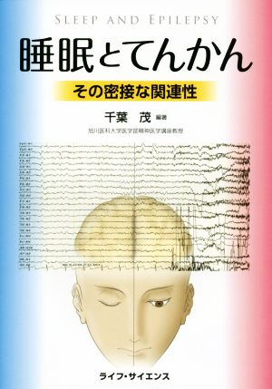 睡眠とてんかん その密接な関連性