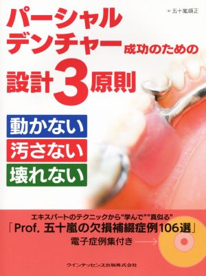 パーシャルデンチャー成功のための設計3原則 動かない 汚さない 壊れない