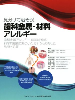 見分けて治そう！歯科金属・材料アレルギー 歯科金属アレルギー1000症例の科学的根拠に基づいた分析からわかった診断と処置