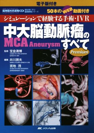 中大脳動脈瘤MCA Aneurysmのすべて シミュレーションで経験する手術・IVR 脳神経外科速報EX部位別に学ぶ脳動脈瘤シリーズ