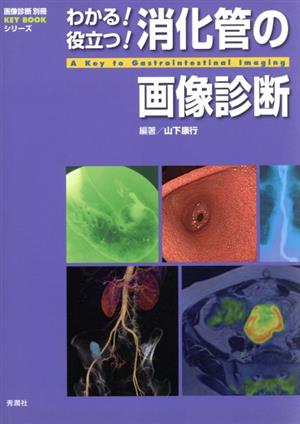 わかる！役立つ！消化管の画像診断画像診断別冊KEY BOOKシリーズ
