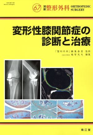 変形性膝関節症の診断と治療 別冊 整形外科