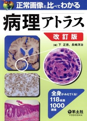 正常画像と比べてわかる病理アトラス 改訂版 全身がみえてくる！118疾患1000画像