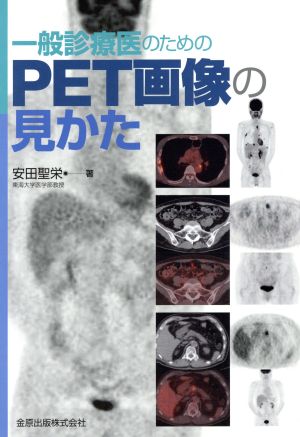 一般診療医のためのPET画像の見かた