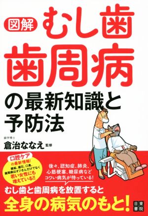 図解 むし歯・歯周病の最新知識と予防法