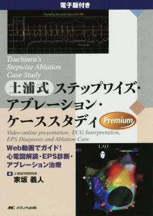 土浦式ステップワイズ・アブレーション・ケーススタディ Web動画でガイド！心電図解読・EPS診断・アブレーション治療