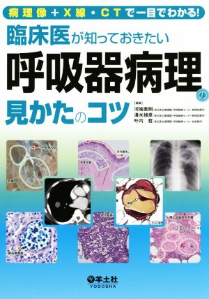 臨床医が知っておきたい 呼吸器病理の見かたのコツ 病理像+X線・CTで一目でわかる！