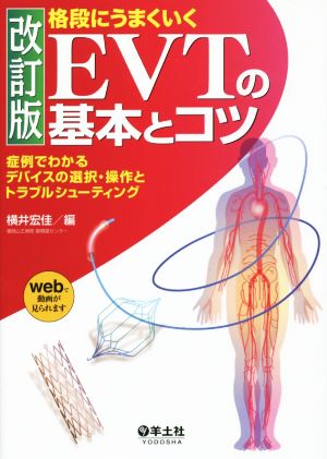 格段にうまくいくEVTの基本とコツ 改訂版