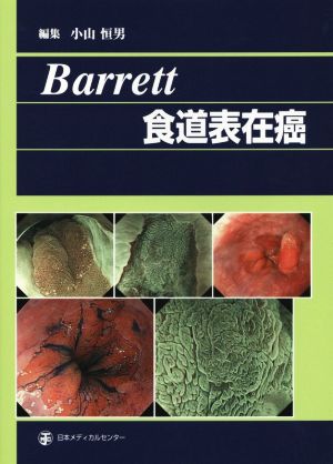 Barrett 食道表在癌