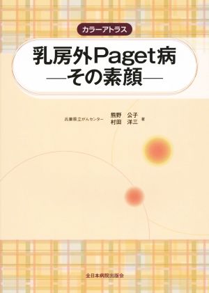 カラーアトラス乳房外Paget病 その素顔