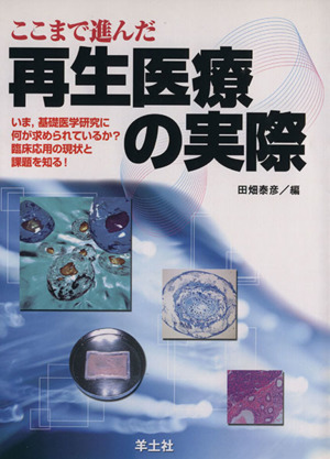 ここまで進んだ再生医療の実際 いま,基礎医学研究に何が求められているか？臨床応用の現状と課題を知る！