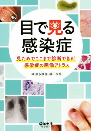 目で見る感染症 見ためでここまで診断できる！感染症の画像アトラス