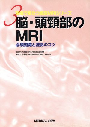 脳・頭頸部のMRI 必須知識と読影のコツ 現場で役立つ臨床MRIシリーズ3