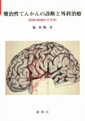 難治性てんかんの診断と外科治療