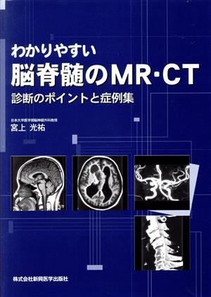 わかりやすい脳脊髄のMR・CT診断のポイントと症例集