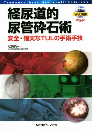 経尿道的尿管砕石術 安全・確実なTULの手術手技