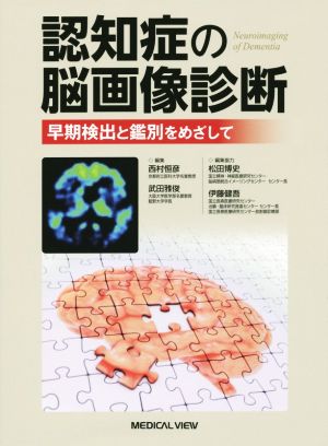 認知症の脳画像診断 早期検出と鑑別をめざして