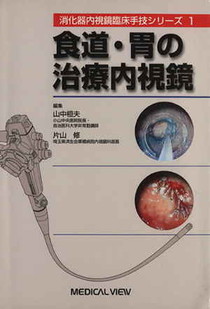 食道・胃の治療内視鏡 消化器内視鏡臨床手技シリーズ1