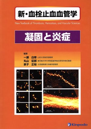 新・血栓止血血管学 凝固と炎症