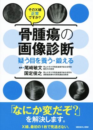 骨腫瘍の画像診断