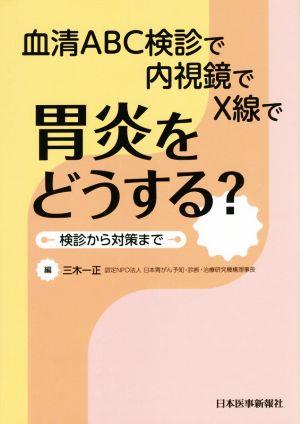 胃炎をどうする？血清ABC検診で内視鏡でX線で胃炎をどうする？