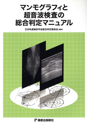 マンモグラフィと超音波検査の総合判定マニュアル