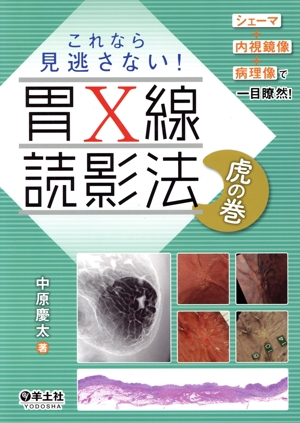 これなら見逃さない！胃X線読影法虎の巻 シェーマ+内視鏡像+病理像で一目瞭然！