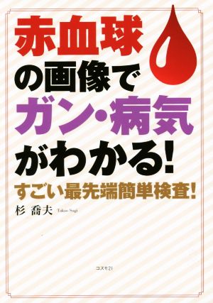 赤血球の画像でガン・病気がわかる！ すごい最先端簡単検査！