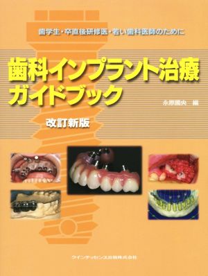 歯科インプラント治療ガイドブック 改訂新版 歯学生・卒直後研修医・若い歯科医師のために