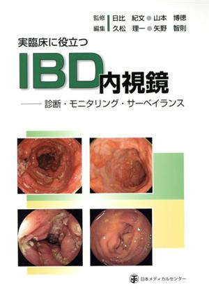 実臨床に役立つIBD内視鏡 診断・モニタリング・サーベイランス