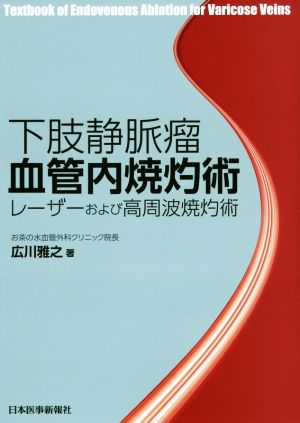 下肢静脈瘤血管内焼灼術 レーザーおよび高周波焼灼術