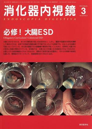 消化器内視鏡(25-3 2013-3) 必修！大腸ESD