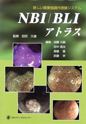 NBI/BLIアトラス新しい画像強調内視鏡システム