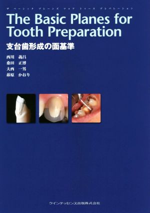 The Basic Planes for Tooth Preparation支台歯形成の面基準
