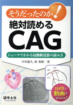 そうだったのか！絶対読めるCGA シェーマでわかる冠動脈造影の読み方