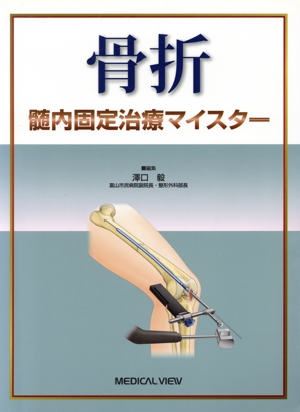 骨折 髄内固定治療マイスター